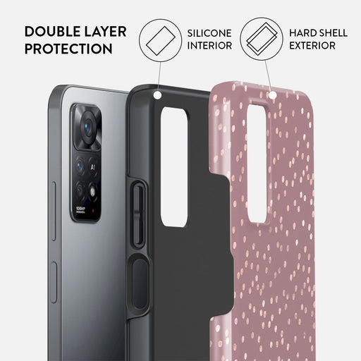 Hot Cocoa - Spotted Xiaomi Redmi Note 11 Pro+ Case 2