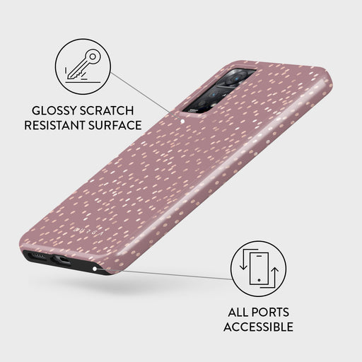Hot Cocoa - Spotted Xiaomi Redmi Note 11 Pro+ Case 3