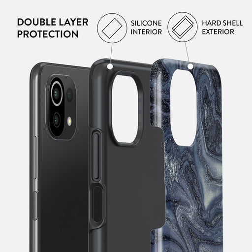 Navy Trench - Blue Xiaomi Mi 11 Lite 4G / 5G Case 2